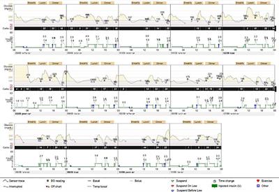 Case Report: Neonatal Diabetes Mellitus Caused by a Novel GLIS3 Mutation in Twins